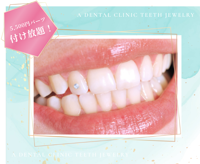 5500円パーツつけ放題