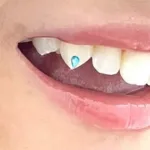 ティースジュエリー💎A Dental Clinic道玄坂